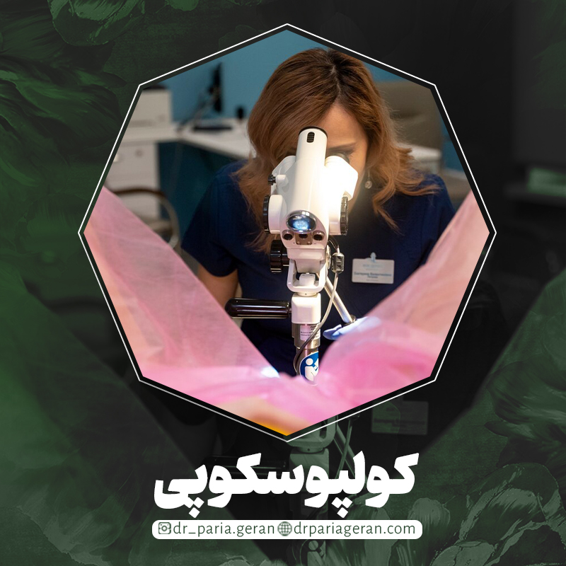کولپوسکوپی