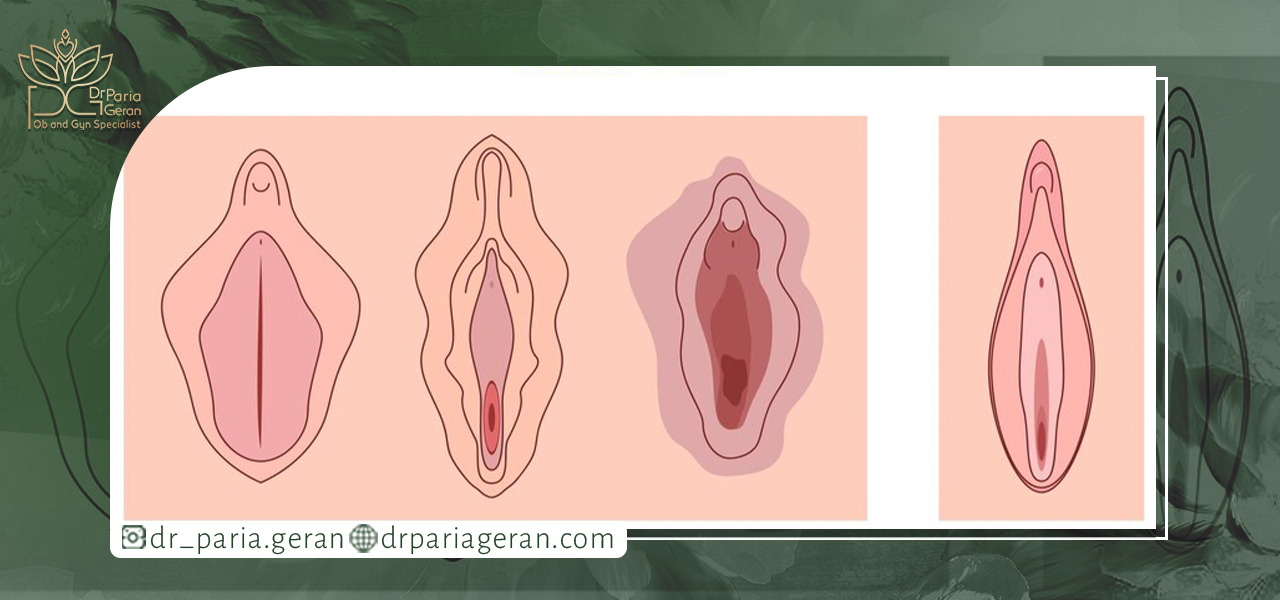 انجام دادن لابیاپلاستی چه دلایلی دارد؟