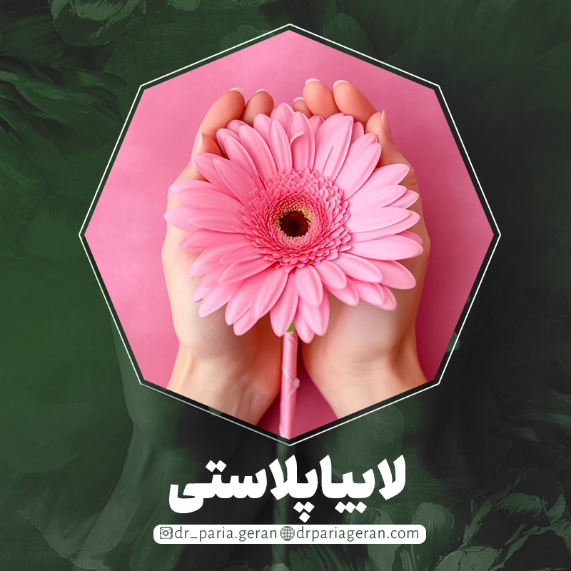 لابیاپلاستی