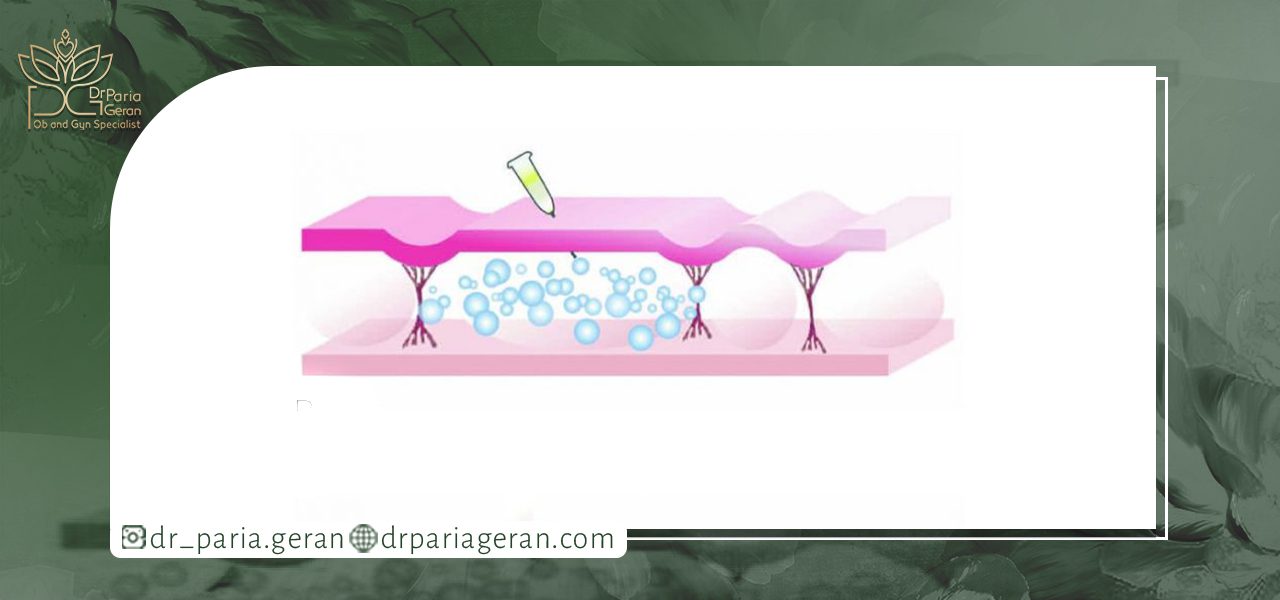 روش انجام کربوکسی تراپی