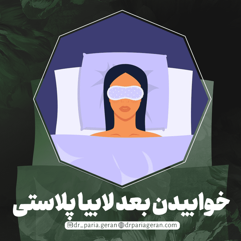 نحوه خوابیدن بعد از جراحی لابیاپلاستی