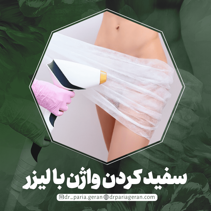 سفید کردن واژن با لیزر